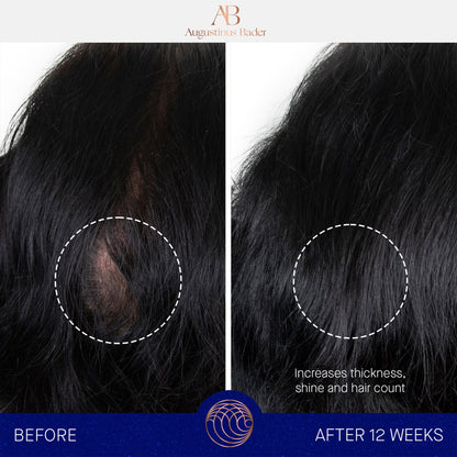 The Scalp treatment