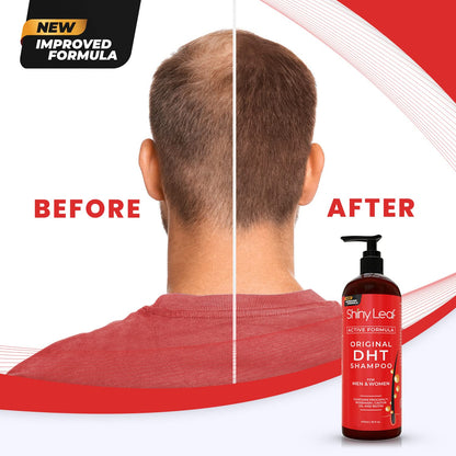 DHT Blocker Hair Loss Shampoo 16 oz, Active Formula For Hair Growth With Biotin