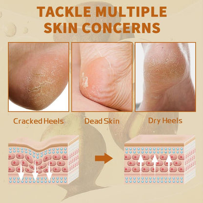 Foot Cream, Urea Cream Stick,For Dry & Cracked Skin,Foot & Hand,Dry Heel,Foot Lotion,Soft Skin