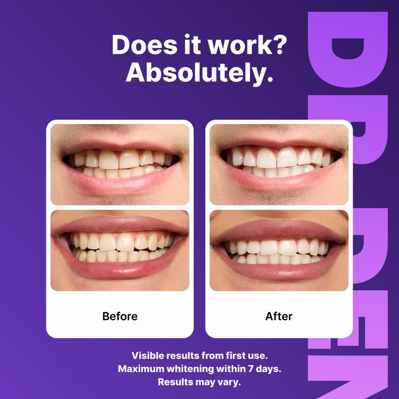 DRDENT Purple Teeth Whitening Strips - 21 Sessions for a Bright Smile - Enamel Safe & Non-Sensitive Formula - Peroxide-Free Whitening Solution
