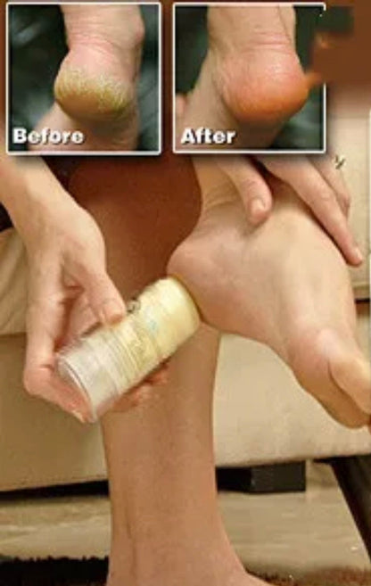Fashionable and effective foot balm Moisturizing Cream Stick (highly recommended)