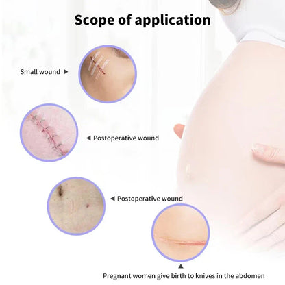 5 Strips Wound Skin Closure Strips | Medical Suture Free Surgical Tape