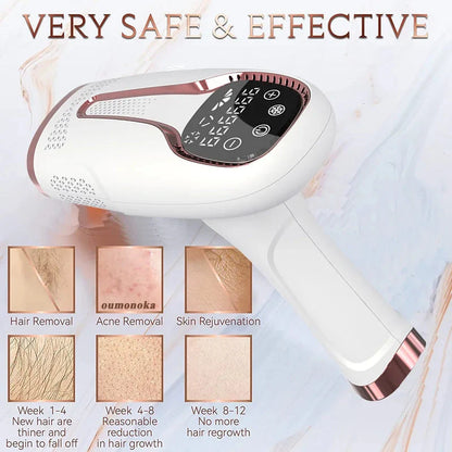 IPL Laser Epilator – Painless Hair Removal Device