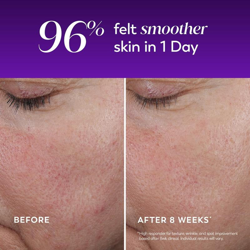 Regenerist Wrinkle Correcting Night Treatment
