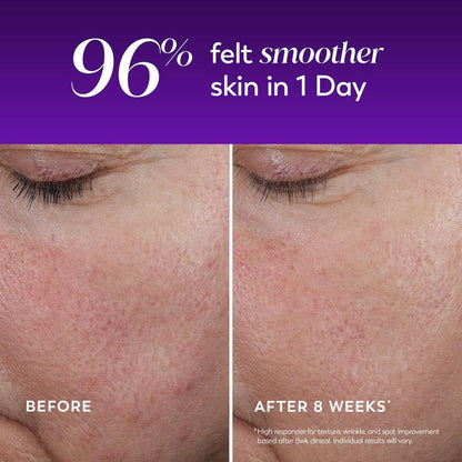 Regenerist Wrinkle Correcting Night Treatment