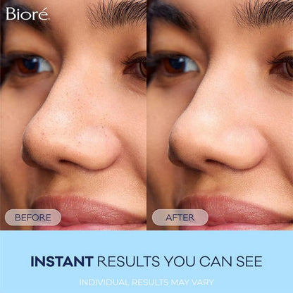 Biore Skincare 8-Count Original Deep Cleansing Pore Strips + GWP 2 Boxes of Blemish Patches!