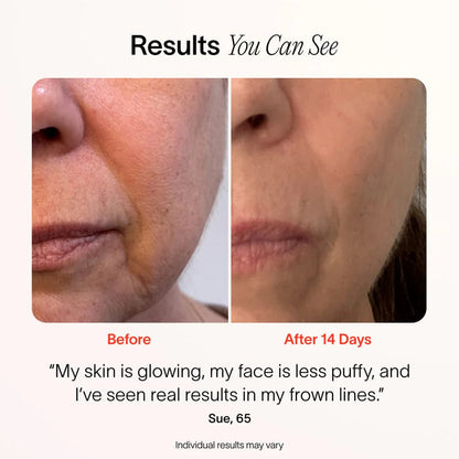 4-In-1 Radiant Renewal Skincare Wand with Red Light Therapy