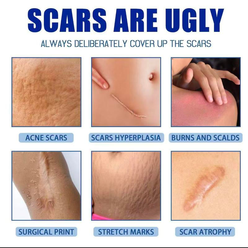 Professional Scar Removal Gelsadvanced Silicone Scar Removal Cream Forburn Acne Old Scar Removal Cream for Face &Body Fades Dark Scars Al Naturalingredientsgentle Formula