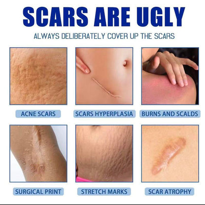 Professional Scar Removal Gelsadvanced Silicone Scar Removal Cream Forburn Acne Old Scar Removal Cream for Face &Body Fades Dark Scars Al Naturalingredientsgentle Formula