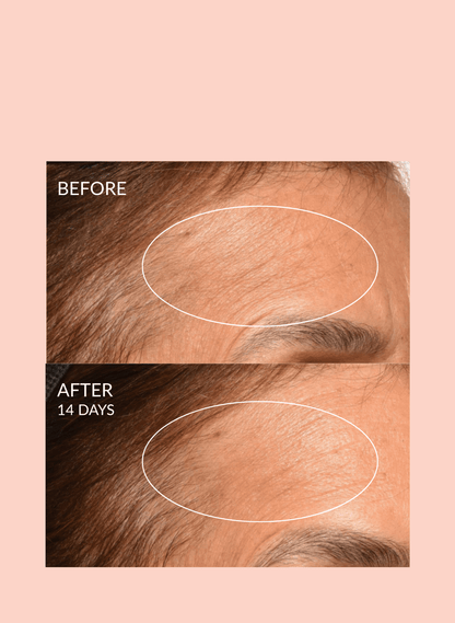 Theorem Serum Boost