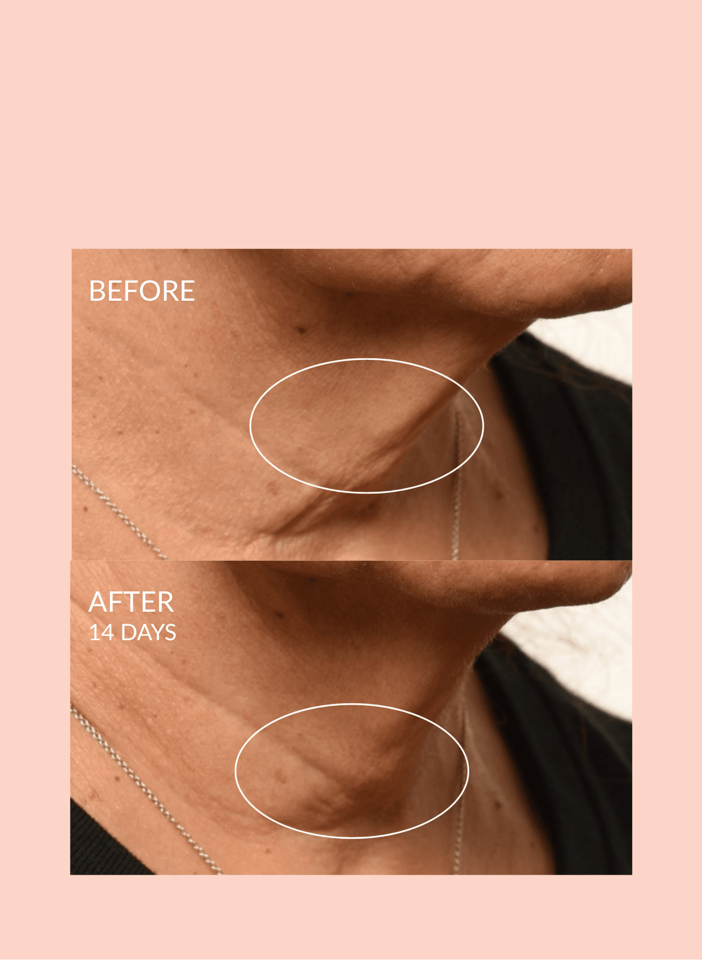 Theorem Serum Boost